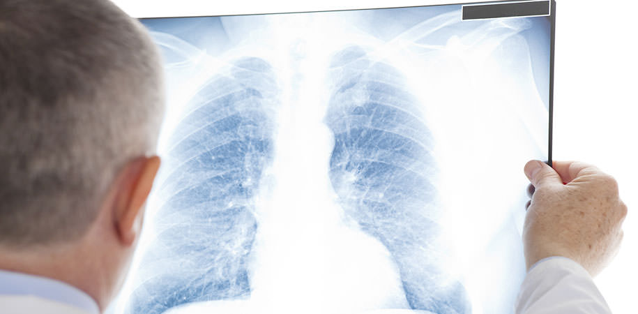 Bildgebung der Lunge